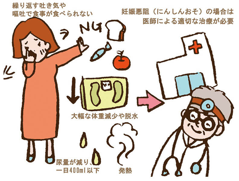 妊娠悪阻の図解