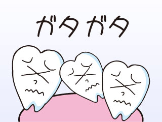 ガタガタの歯並び